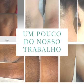 Comprar o produto de Agende seu Horário. em Depilação em Botucatu, SP por Solutudo Comprar o produto de Agende seu Horário. em Depilação em Botucatu, SP por Solutudo