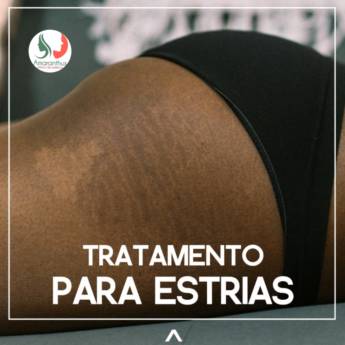 Comprar o produto de Tratamento para estrias em Clínicas de Estética e Beleza em Bauru, SP por Solutudo