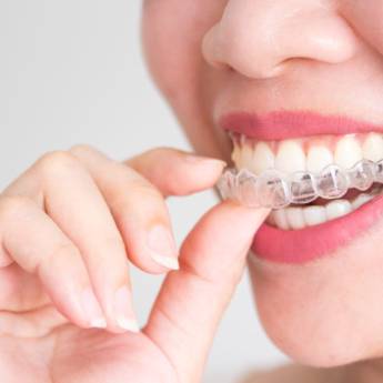 Comprar o produto de Ortodontia - Tratamentos de Correção em Estética Odontológica em Jundiaí, SP por Solutudo