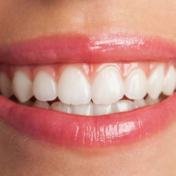 Comprar o produto de Lentes de contato dentais em Estética Odontológica em Jundiaí, SP por Solutudo