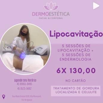 Comprar o produto de Combo de Lipocavitação + Endermologia em Ofertas: Saúde e Beleza em Foz do Iguaçu, PR por Solutudo
