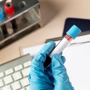 Comprar o produto de Bioquímica em Exames  em Picos, PI por Solutudo