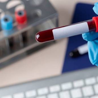 Comprar o produto de Coagulograma em Exames  em Picos, PI por Solutudo