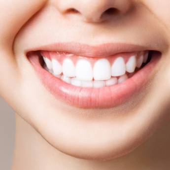 Comprar o produto de Clareamento Dental em Odontologia em Botucatu, SP por Solutudo