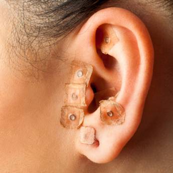 Comprar o produto de Auriculoterapia em Acupuntura em São Paulo, SP por Solutudo