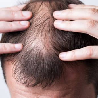 Comprar o produto de Acupuntura capilar  em Acupuntura em Bauru, SP por Solutudo