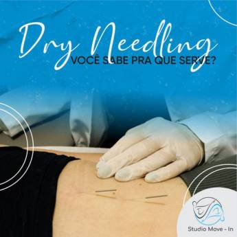 Comprar o produto de Dry Needling em Avaré  em Fisioterapia pela empresa Studio Move In em Avaré  em Avaré, SP por Solutudo