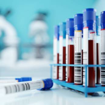 Comprar o produto de Exames Toxicológicos - Geral em Laboratórios Clínicos em Salvador, BA por Solutudo