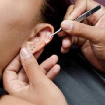 Comprar o produto de Auriculoterapia em Massoterapia em Jundiaí, SP por Solutudo