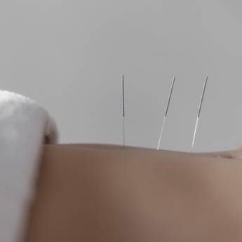 Comprar o produto de Acuputura em Acupuntura em Apucarana, PR por Solutudo