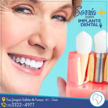 Comprar o produto de Implantes em Implantes em Cândido Mota, SP por Solutudo