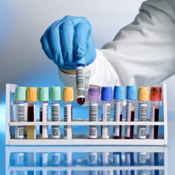 Comprar o produto de Exames Laboratoriais em Exames  em Vitória da Conquista, BA por Solutudo