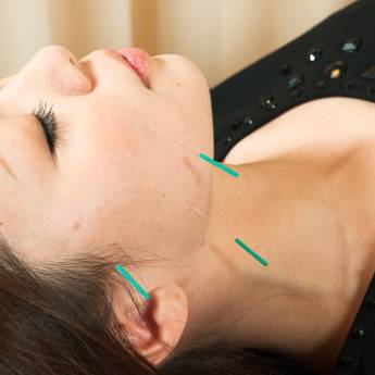 Comprar o produto de Acupuntura japonesa em Acupuntura em Marília, SP por Solutudo