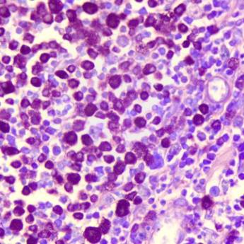 Comprar o produto de Colorações especiais em Anatomia Patologica em Botucatu, SP por Solutudo