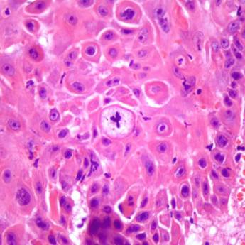 Comprar o produto de Histopatológico em Anatomia Patologica em Botucatu, SP por Solutudo