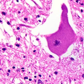 Comprar o produto de Coleta de material para análise de raiva em Anatomia Patologica em Botucatu, SP por Solutudo