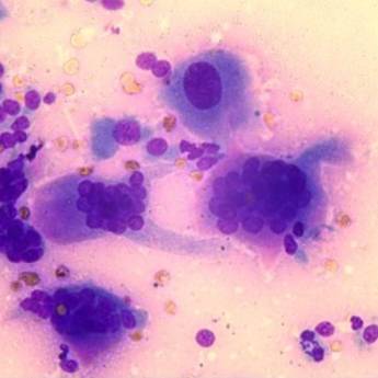 Comprar o produto de Citopatológico em Anatomia Patologica em Botucatu, SP por Solutudo