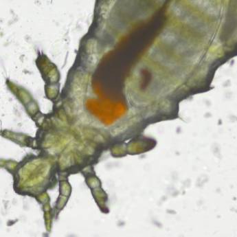 Comprar o produto de Parasitológico de raspado cutâneo em Anatomia Patologica em Botucatu, SP por Solutudo