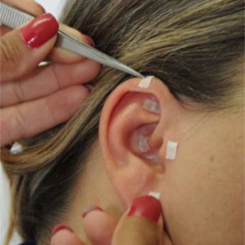 Comprar o produto de Auriculoterapia em Auriculoterapia em Jundiaí, SP por Solutudo