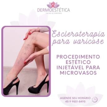 Comprar o produto de Escleroterapia para Varicose  em Beleza, Estética e Bem Estar em Foz do Iguaçu, PR por Solutudo