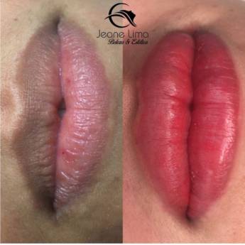 Comprar o produto de Micropigmentação Labial em Micropigmentação  em Presidente Dutra, MA por Solutudo