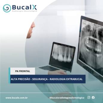 Comprar produto PA Frontal - Radiologia Odontológica  em Radiologia Odontológica pela empresa Bucalx Radiologia Odontológica em Botucatu, SP