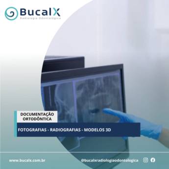 Comprar o produto de Documentação Ortodôntica  em Radiologia Odontológica em Botucatu, SP por Solutudo