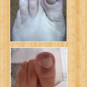 Comprar o produto de Higienizar todo o pé para combater fungos em Pedicure em Assis, SP por Solutudo