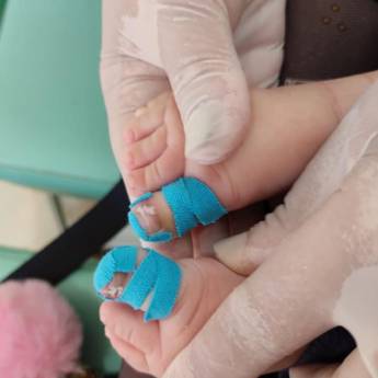 Comprar o produto de Remover e cuidar de calos e calosidades em Pedicure em Assis, SP por Solutudo