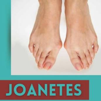Comprar o produto de Joanete  em Podologia em Indaiatuba, SP por Solutudo