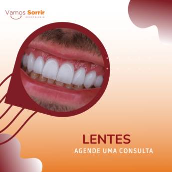 Comprar o produto de Lentes em Odontologia em Botucatu, SP por Solutudo