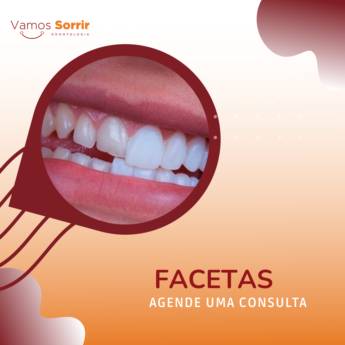 Comprar o produto de Facetas em Odontologia em Botucatu, SP por Solutudo