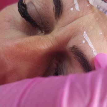 Comprar o produto de Botox Facial em Clínicas de Estética e Beleza em Foz do Iguaçu, PR por Solutudo