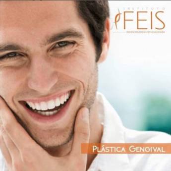 Comprar o produto de Tratamentos Estéticos Gengivais em Odontologia pela empresa Instituto Feis - RT Dr. Ricardo Feitosa CRO-SP 77583 em Assis, SP por Solutudo