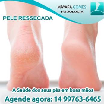 Comprar o produto de Pele Ressecada (Rachaduras) em Podologia em Botucatu, SP por Solutudo