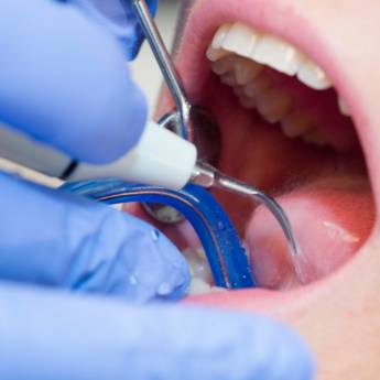 Comprar o produto de Dentista para aplicação de lente de contato dental em Bauru  em Odontologia em Bauru, SP por Solutudo