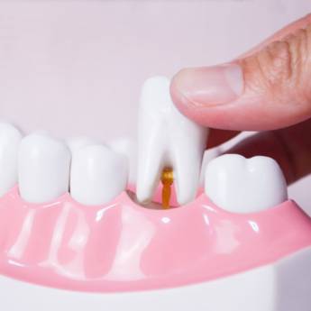 Comprar o produto de Dentista para extração de dente em Bauru  em Odontologia em Bauru, SP por Solutudo