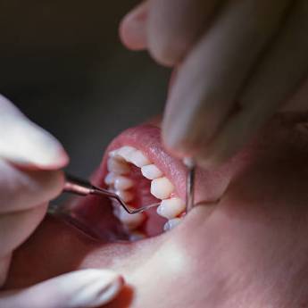 Comprar o produto de Periodontia em Odontologia em Bofete, SP por Solutudo