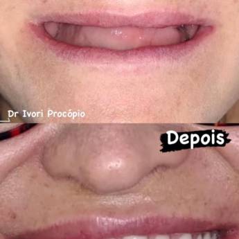 Comprar o produto de Odontologia em São Paulo – Odonto Los Angeles em Odontologia em São Paulo, SP por Solutudo