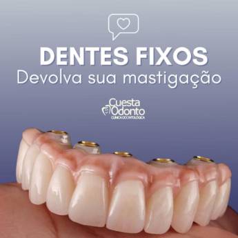 Comprar o produto de Prótese Fixa em Próteses Dentárias em Barra Bonita, SP por Solutudo