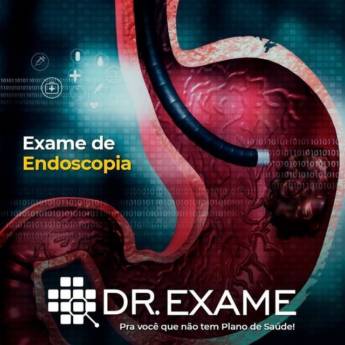 Comprar o produto de Endoscopia em Exames  em Vitória da Conquista, BA por Solutudo