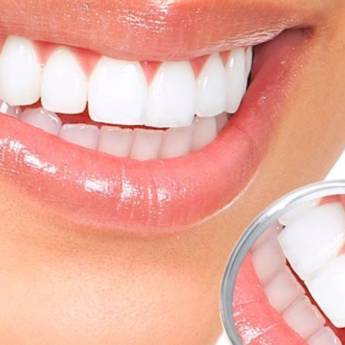 Comprar produto Estética Oral em Odontologia pela empresa IREO - Instituto de Reabilitação e Estética Orofacial e Corporal em Aracaju, SE