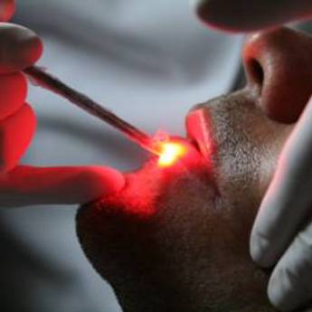 Comprar produto Laserterapia em Odontologia pela empresa IREO - Instituto de Reabilitação e Estética Orofacial e Corporal em Aracaju, SE