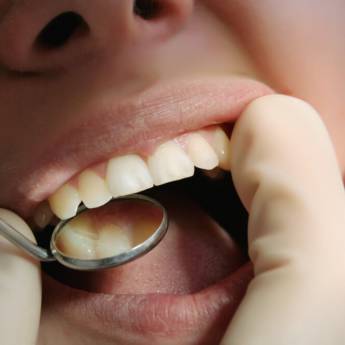 Comprar o produto de Reabilitação Oral em Odontologia em Aracaju, SE por Solutudo