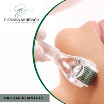 Comprar o produto de MICROAGULHAMENTO em Clínicas de Estética e Beleza em Botucatu, SP por Solutudo