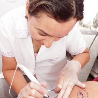 Comprar o produto de Jato de plasma em Estética Facial em Frutal, MG por Solutudo