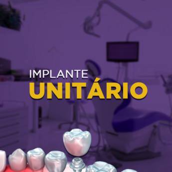 Comprar o produto de Implantes Dentários em Odontologia em Avaré, SP por Solutudo
