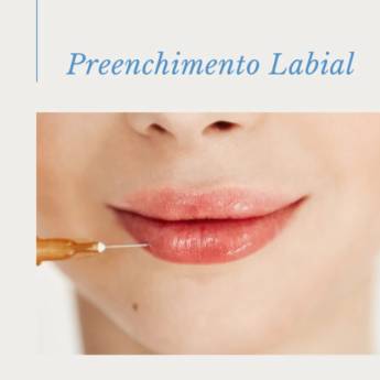 Comprar o produto de  Preenchimento Labial em Bauru em Estética Facial em Bauru, SP por Solutudo