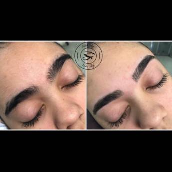 Comprar o produto de Remoção de verrugas em MICROPIGMENTAÇÃO em Aracaju, SE por Solutudo