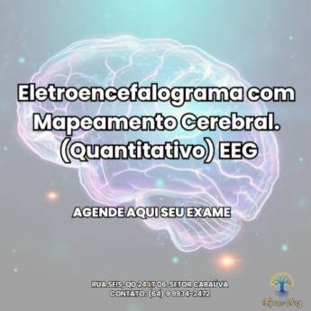 Comprar produto Eletroencefalograma com Mapeamento Cerebral em Saúde pela empresa Espaço Vivaz em Mineiros, GO